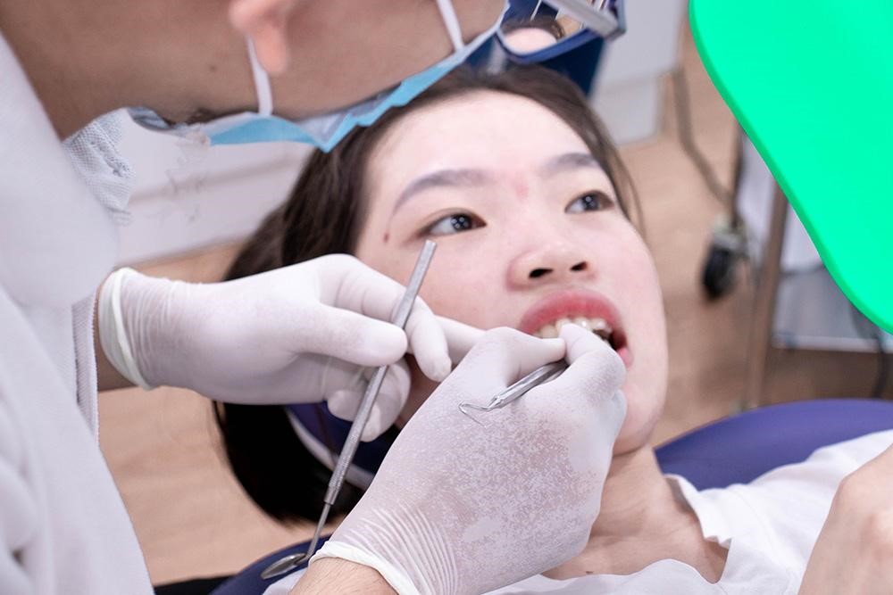 Trồng răng Implant là phương pháp phục hồi răng đã mất được nhiều người lựa chọn hiện nay