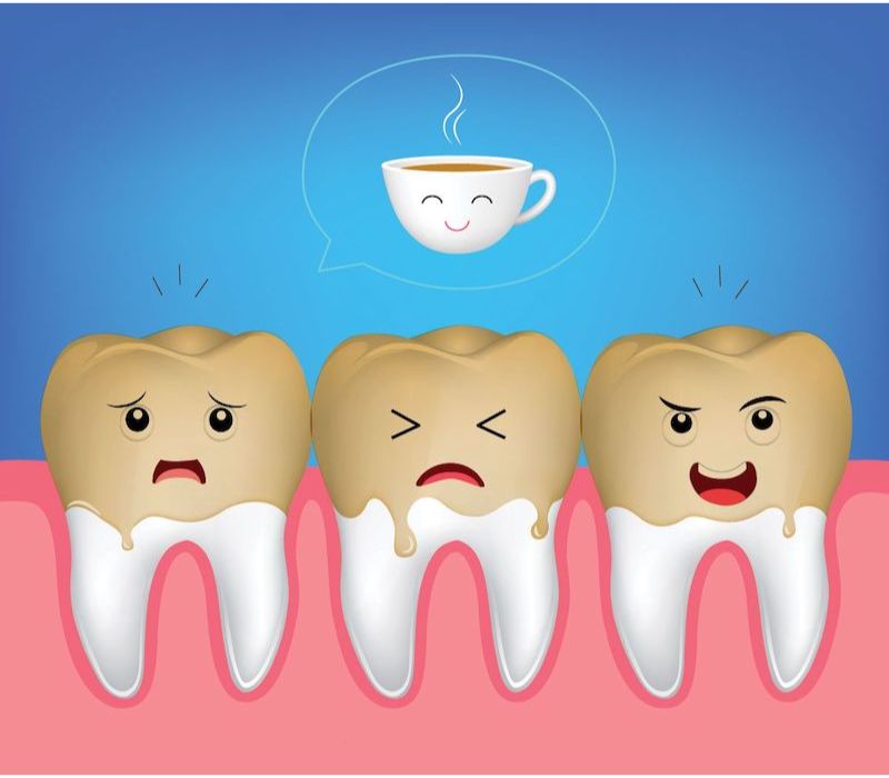 LÀM RĂNG SỨ CÓ CẦN KIÊNG CÁC THỨC ĂN, NƯỚC UỐNG CÓ MÀU KHÔNG? CÁCH CHĂM SÓC SAU KHI LÀM RĂNG SỨ