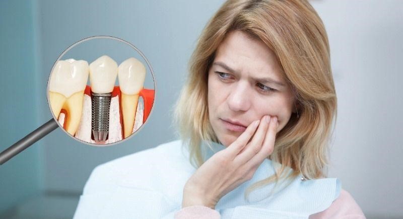 NHỮNG BIẾN CHỨNG CÓ THỂ GẶP KHI LÀM IMPLANT VÀ CÁCH XỬ LÝ