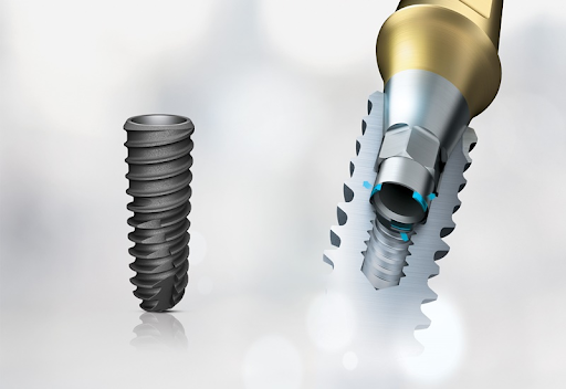 IMPLANT OSSTEM - LỰA CHỌN HOÀN HẢO THAY THẾ MẤT RĂNG MỘT CÁCH HIỆU QUẢ 2 implant osstem lua chon hoan hao thay the mat rang mot cach hieu qua 1
