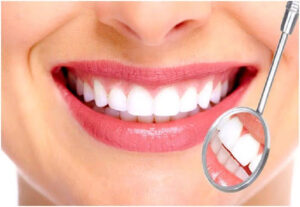Quy trình xử lý răng sứ bị mẻ tại Nha khoa Dr.SmileCare