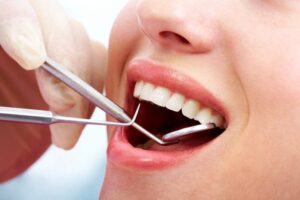 Vì sao nên khám răng định kỳ?