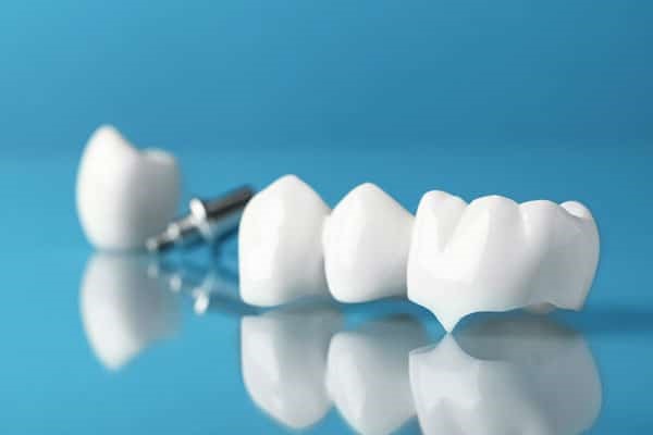 Bọc răng sứ là gì