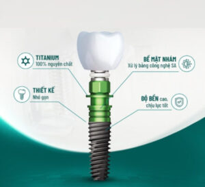 Trồng răng Implant